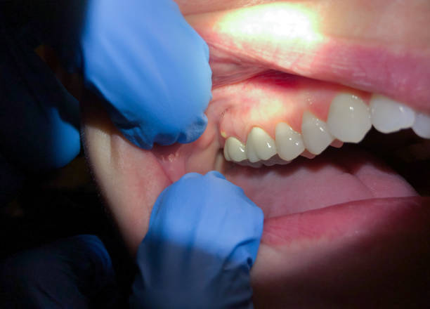 Best Weekend Emergency Dentist in Thayer, MO