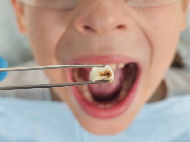 Best Emergency Treatment for Toothache in Thayer, MO